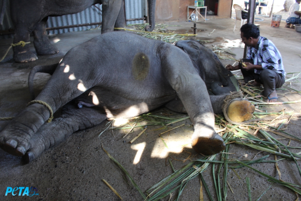 Suman had a healed puncture wound on the right chest region